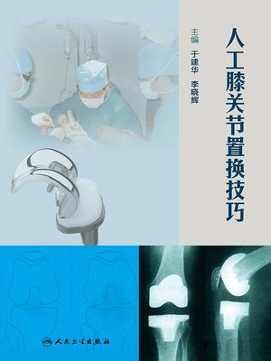 cover image of 人工膝关节置换技巧